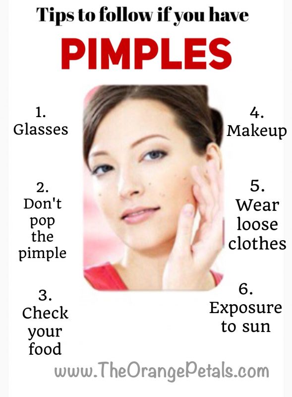 tips to follow to reduce pimples