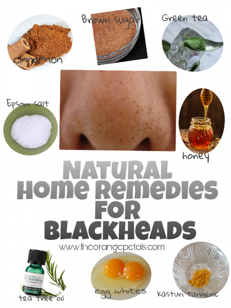 Natural Home remedies for blackheads 